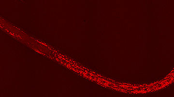 Picture of a nematode. (Image: Roberta Galli, TU Dresden)